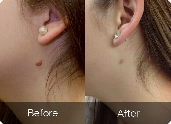 Click image for larger version

Name:	dataurl767181.jpg
Views:	44
Size:	38.4 KB
ID:	5175