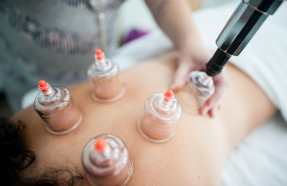 Click image for larger version

Name:	9-Cupping-Therapy-NYC.jpg
Views:	29
Size:	75.4 KB
ID:	20226