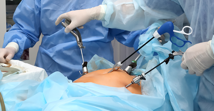 Click image for larger version

Name:	laparoscopic.png
Views:	12
Size:	449.3 KB
ID:	80723