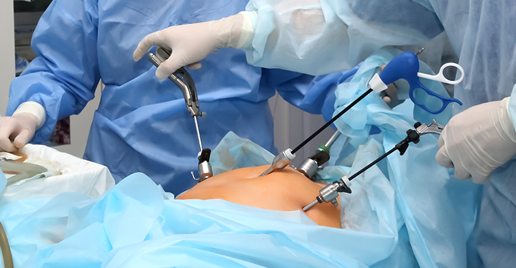 Click image for larger version

Name:	laparoscopic.png
Views:	6
Size:	449.3 KB
ID:	80723