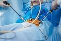 Click image for larger version

Name:	laproscopy ct nursing home (2).jpg
Views:	37
Size:	11.0 KB
ID:	81017
